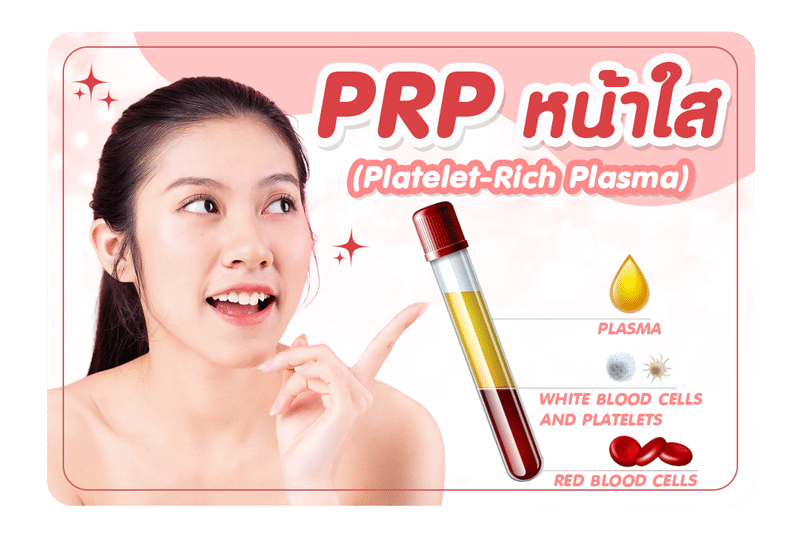ฉีด PRP หน้าใส – Platelet Rich Plasma